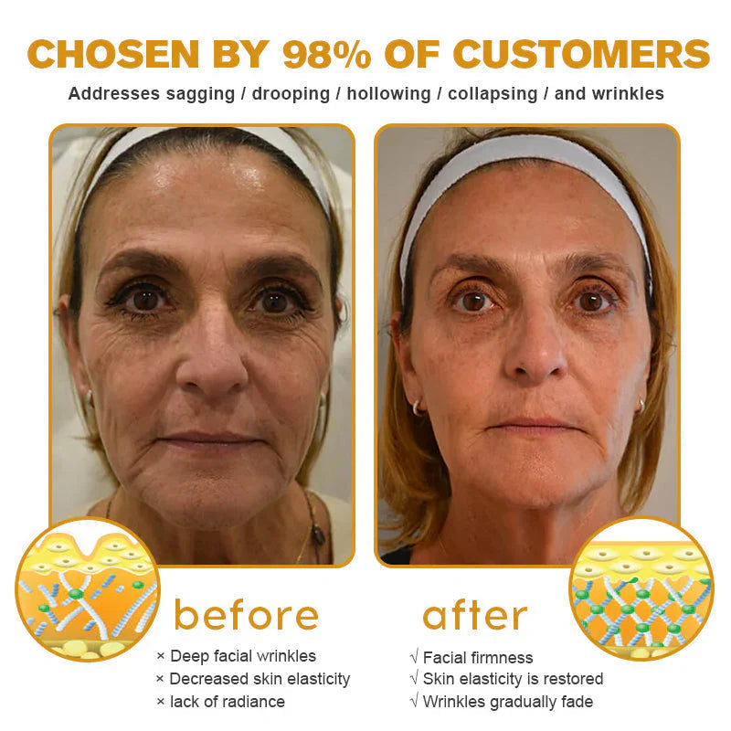 HOOMWELL™ Κρέμα αφαίρεσης ρυτίδων Botox με δηλητήριο μέλισσας