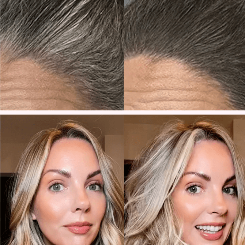 Η πούδρα Hairline καλύπτει άμεσα την τριχόπτωση, την αναγέννηση και την τροποποίηση της τρίχας.