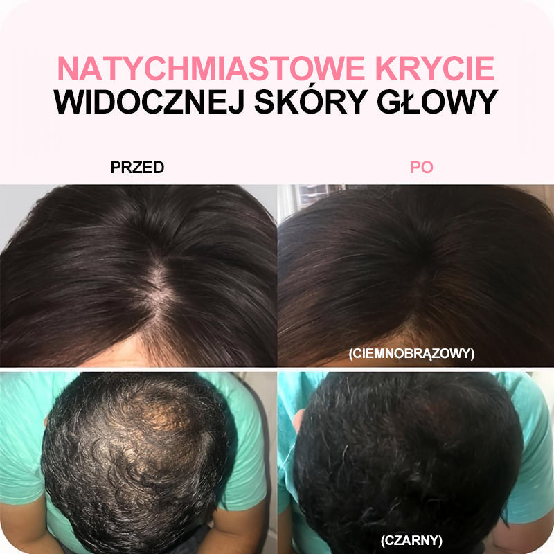 Πούδρα Hairline που καλύπτει άμεσα την τριχόπτωση, πούδρα μαλλιών για ρετούς ρουζ